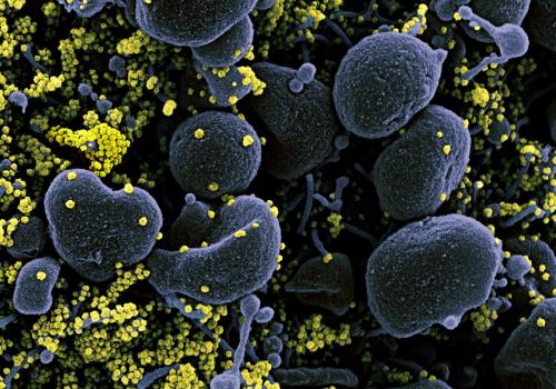 SARS-CoV-2 and apoptotic infected cell