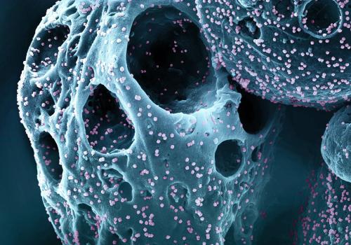 Cell infected with SARS-CoV-2