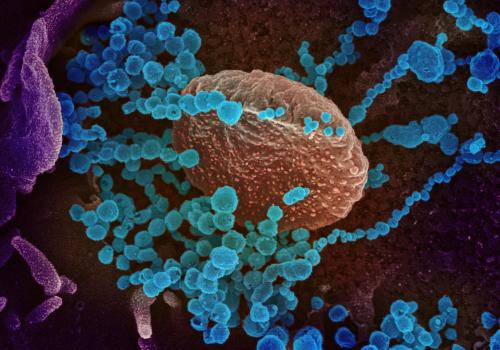 Cell infected with SARS-CoV-2