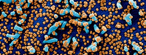 SARS-CoV-2 and cells